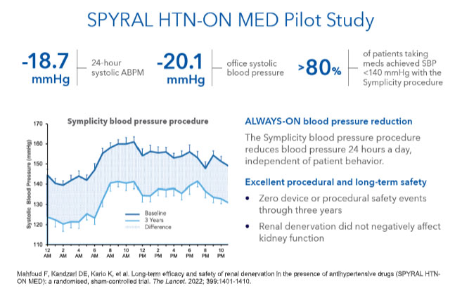 Spyral HTN-ON Med Pilot Study