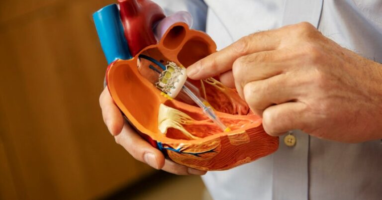 Transcatheter aortic valve replacement (TAVR)